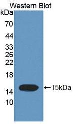 TCHH Antibody in Western Blot (WB)