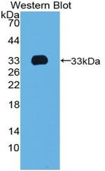 TBX4 Polyclonal Antibody