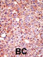 MGAT3 Polyclonal Antibody