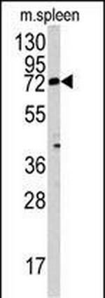MGAT3 Antibody in Western Blot (WB)