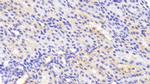 Tankyrase 2 Polyclonal Antibody