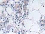 SRY Antibody in Immunohistochemistry (Paraffin) (IHC (P))
