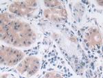 SRY Antibody in Immunohistochemistry (Paraffin) (IHC (P))