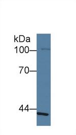 SLFN5 Antibody in Western Blot (WB)