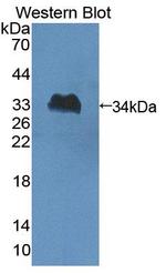 SLFN5 Antibody in Western Blot (WB)