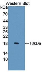 SLC22A4 Polyclonal Antibody