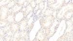 SGPL1 Polyclonal Antibody