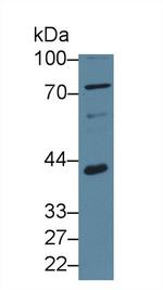 SERPINB3/SERPINB4 Antibody in Western Blot (WB)