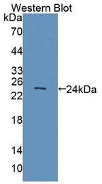 SERPINB3/SERPINB4 Antibody in Western Blot (WB)