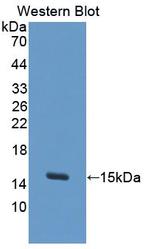 S100A7A Polyclonal Antibody