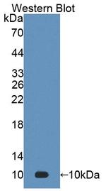S100A7 Polyclonal Antibody