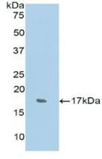 RNASE7 Antibody in Western Blot (WB)