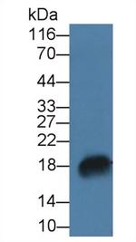 RNASE7 Antibody in Western Blot (WB)