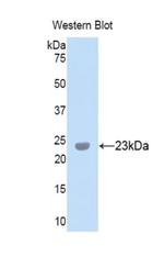 PXDN Polyclonal Antibody