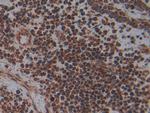 PLAA Antibody in Immunohistochemistry (Paraffin) (IHC (P))