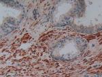 PLAA Antibody in Immunohistochemistry (Paraffin) (IHC (P))