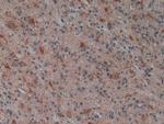 PLAA Antibody in Immunohistochemistry (Paraffin) (IHC (P))
