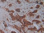 PLAA Antibody in Immunohistochemistry (Paraffin) (IHC (P))