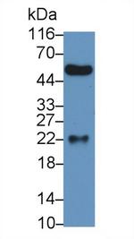 PGRP-S Antibody in Western Blot (WB)