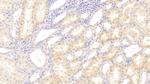 PCDHB2 Antibody in Immunohistochemistry (Paraffin) (IHC (P))