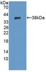 PADI6 Polyclonal Antibody