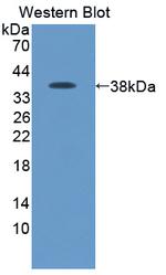 PADI3 Polyclonal Antibody