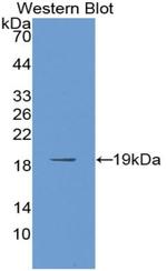 PABPC1L Polyclonal Antibody