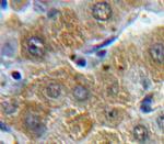 ORM1 Polyclonal Antibody