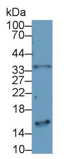 NMB Polyclonal Antibody