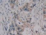 MPEG1 Antibody in Immunohistochemistry (Paraffin) (IHC (P))