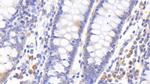 MT1 Polyclonal Antibody