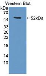LACRT Antibody in Western Blot (WB)
