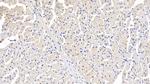 ITGA11 Polyclonal Antibody