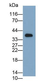 ITGA11 Antibody in Western Blot (WB)