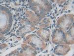 IL20RB Antibody in Immunohistochemistry (Paraffin) (IHC (P))