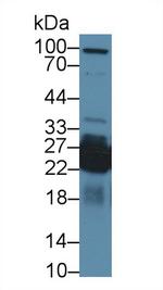 SHISA4 Antibody in Western Blot (WB)