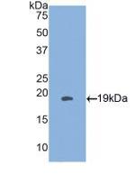 HSPB3 Antibody in Western Blot (WB)