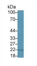 hCG beta-1 Antibody in Western Blot (WB)