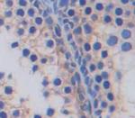 GLUT14 Polyclonal Antibody