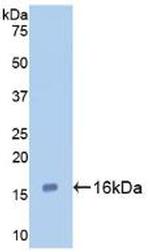Galectin 7 Antibody in Western Blot (WB)