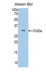 FSCN2 Antibody in Western Blot (WB)