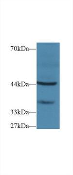 FBRS Polyclonal Antibody