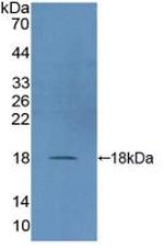 DUSP5 Polyclonal Antibody