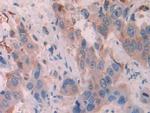 Cytokeratin 6C Antibody in Immunohistochemistry (Paraffin) (IHC (P))