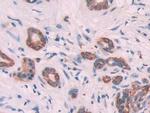 Cytokeratin 6C Polyclonal Antibody