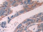 Cytokeratin 6C Antibody in Immunohistochemistry (Paraffin) (IHC (P))