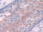 Cytokeratin 6C Antibody in Immunohistochemistry (Paraffin) (IHC (P))