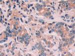 Cytokeratin 6C Antibody in Immunohistochemistry (Paraffin) (IHC (P))