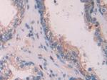 Cytokeratin 6C Antibody in Immunohistochemistry (Paraffin) (IHC (P))