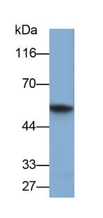 Cytokeratin 6C Antibody in Western Blot (WB)